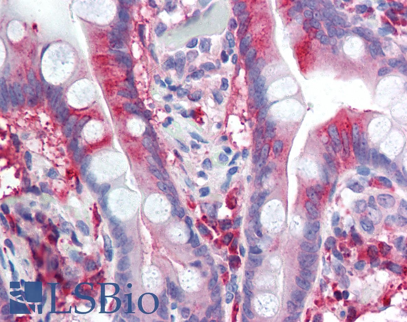 IHC-plus™ Polyclonal Rabbit anti-Human CACNA1C / Cav1.2 Antibody (Internal, IHC)