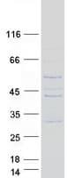 Human FAM71F1 Protein (Recombinant Myc-DDK (Flag))