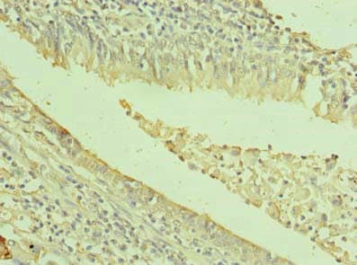 Polyclonal Rabbit anti-Human TXNDC11 Antibody (IHC)