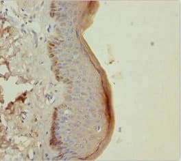 KRT6A / CK6A / Cytokeratin 6A Antibody