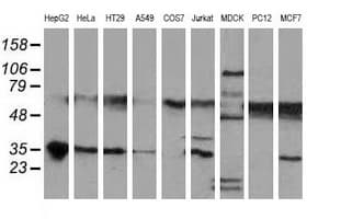 NHEJ1 / XLF Antibody (clone OTI1E2)