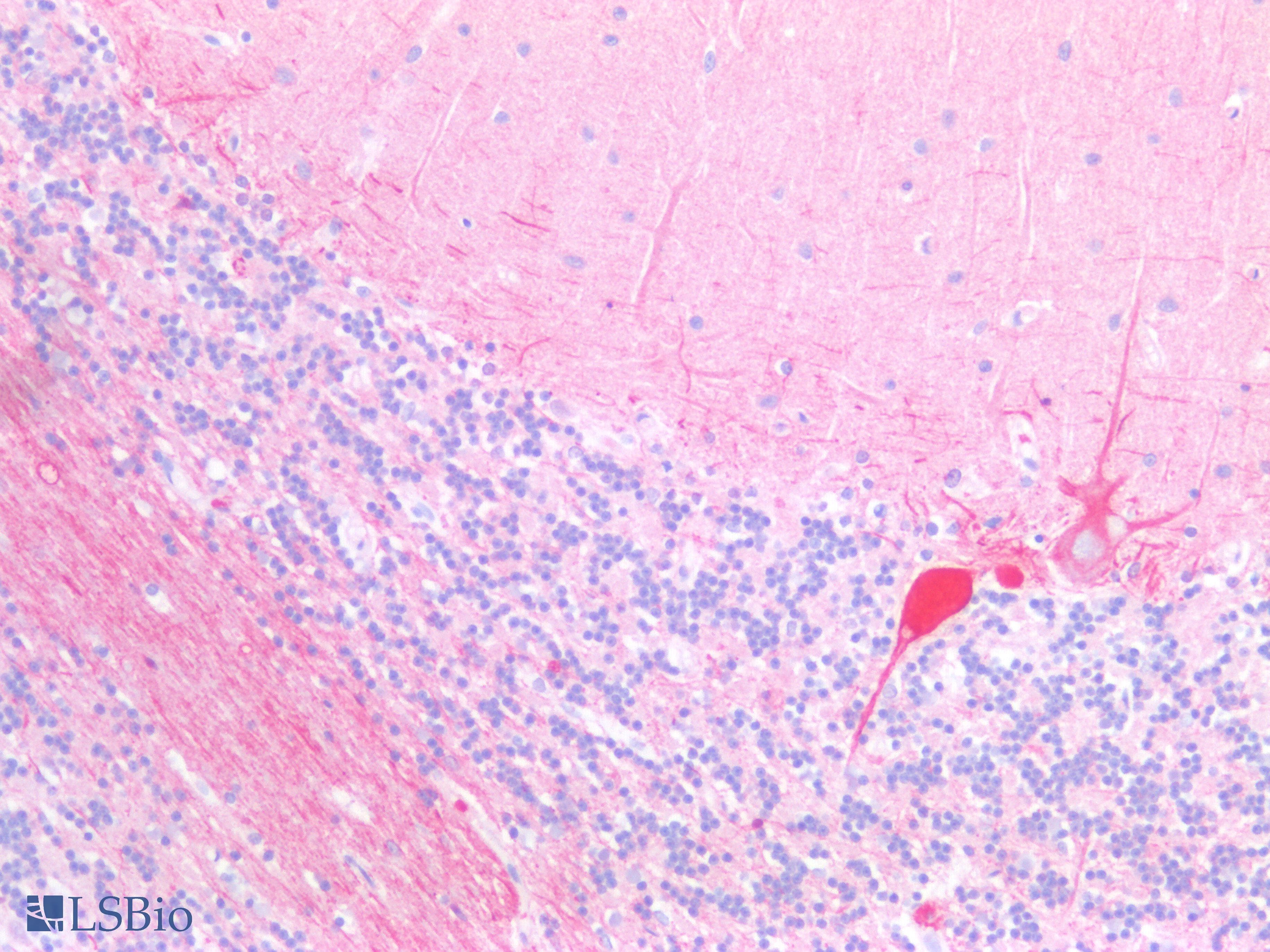 Polyclonal Rabbit anti-Human GNA11 Antibody (aa1-359, IHC, WB)