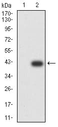 CTNNB1 / Beta Catenin Antibody (clone 7C5A2)