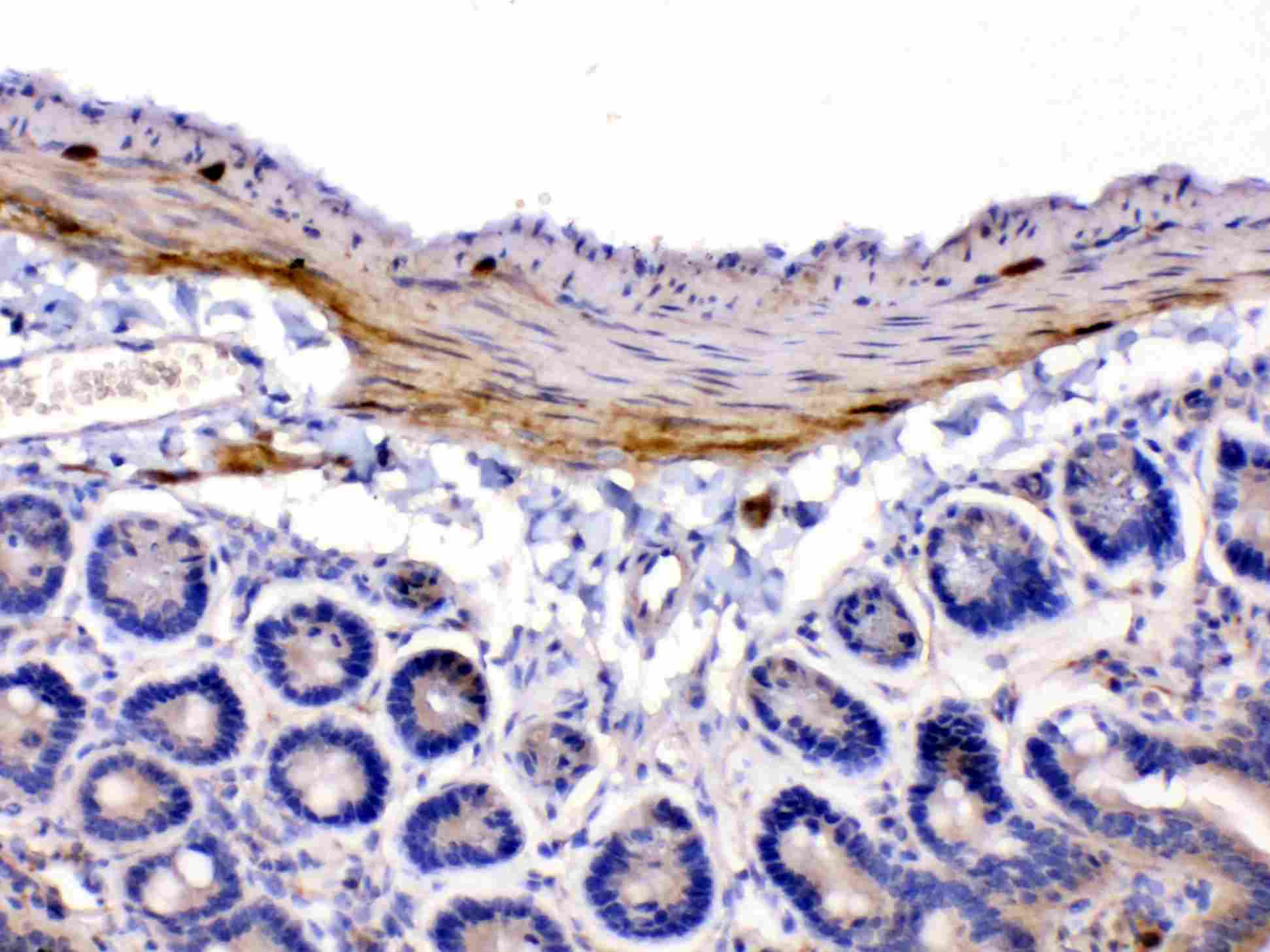 Polyclonal Rabbit anti-Human CHRNA5 Antibody (IHC, WB)