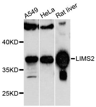 LIMS2 Antibody