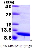 Human S100A8 / MRP8 Protein (Recombinant)