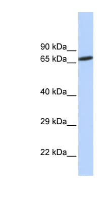 ZNF571 Antibody (aa144-193)