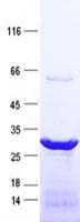Human LRP5L Protein (Recombinant His, N-Terminal)