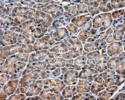 PIM2 / Pim-2 Antibody (clone OTI5D5)