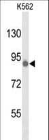 TLK1 Antibody (aa720-750)