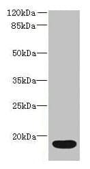 IL36RN / IL1F5 Antibody (aa1-155)
