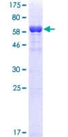 Human RRM2 Protein (Recombinant GST)