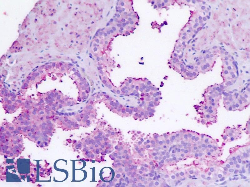 PathPlus™ RXFP1/ LGR7 Antibody (C-Terminus)