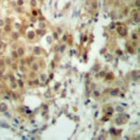 RPS6KA5 / MSK1 Antibody (Internal)
