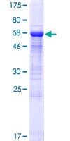 Human MGC11296 / BRMS1L Protein (Recombinant GST)
