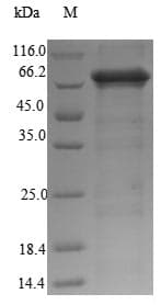 Rat PCSK2 Protein (Recombinant 6His, N-terminus)