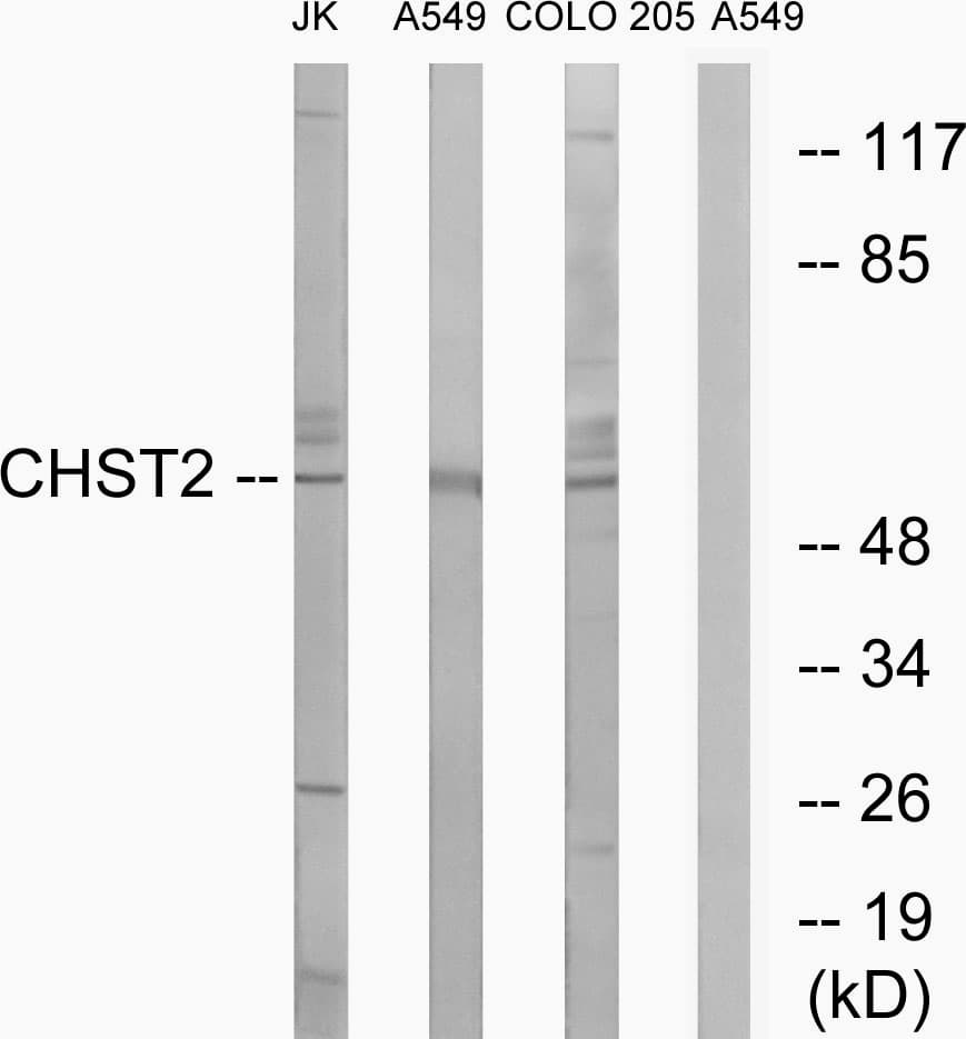 Polyclonal Rabbit anti-Human CHST2 Antibody (aa1-50, WB)
