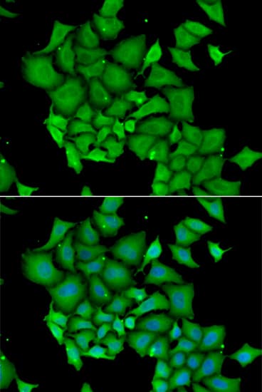 DFFA / ICAD / DFF45 Antibody