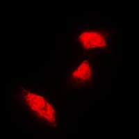IHC-plus™ KRT18 / CK18 / Cytokeratin 18 Antibody (C-Terminus)