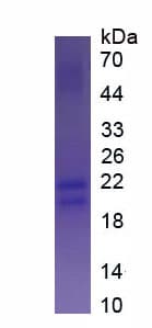 Human MUC5AC Protein (Recombinant His-S)