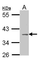 MC1R Antibody (aa253-317)
