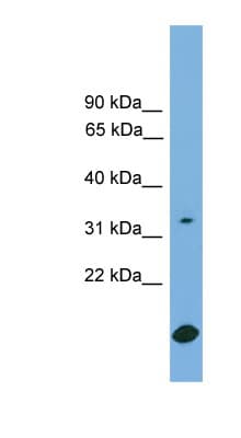 RAB9A / RAB9 Antibody (aa71-120)
