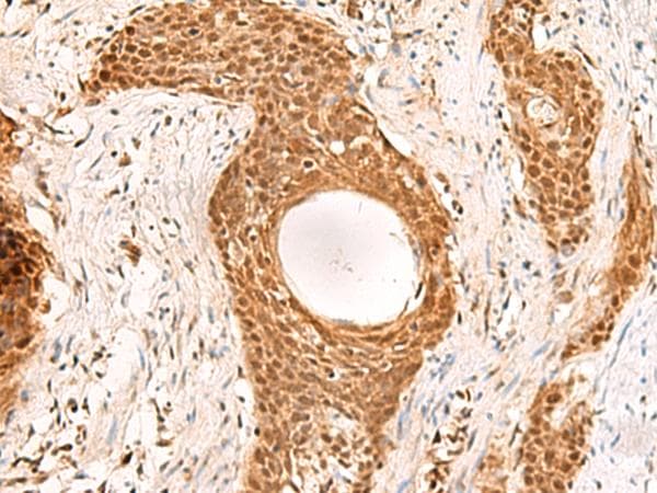 RMND5B Antibody