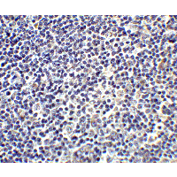 IL17A Antibody