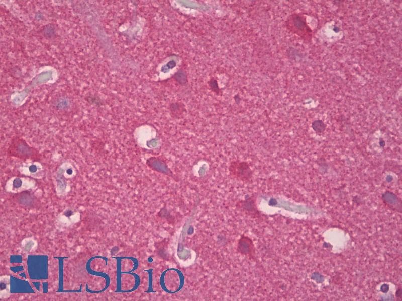 IHC-plus™ Synuclein Antibody (aa15-64)