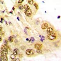 GATA5 Antibody (Internal)