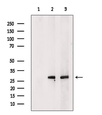 Polyclonal Rabbit anti-Human C19orf52 Antibody (IF, WB)