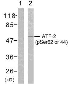 ATF2 Antibody (phospho-Ser62 or 44)