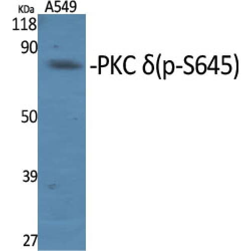 PRKCD / PKC-Delta Antibody (580-660 aa)