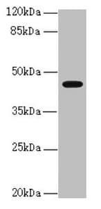 Polyclonal Rabbit anti-Human RFPL2 Antibody (IHC, WB)