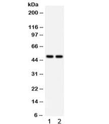 Polyclonal Rabbit anti-Human SOX4 Antibody (WB)