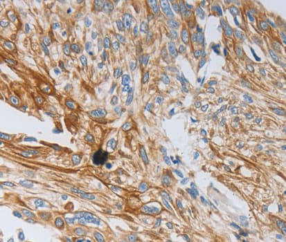 NTF3 / Neurotrophin 3 Antibody