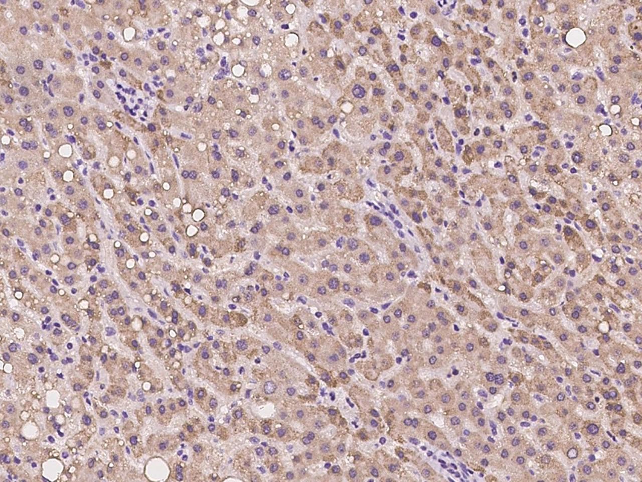 Polyclonal Rabbit anti-Human SPICE1 / CCDC52 Antibody (IHC)