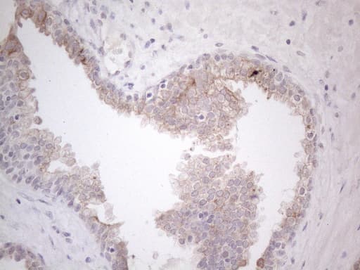 Monoclonal Mouse anti-Human HGF / Hepatocyte Growth Factor Antibody (clone OTI1D2, aa200-494, IHC, WB)