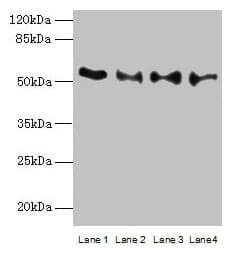 Polyclonal Rabbit anti-Human TRIM15 Antibody (IHC, WB)