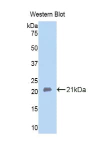 CA12 / Carbonic Anhydrase XII Antibody (aa154-307, Biotin)