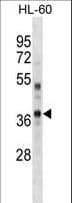IHC-plus™ PBK / TOPK Antibody (aa286-317)