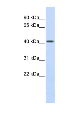 CPB2 / TAFI Antibody (aa324-373)
