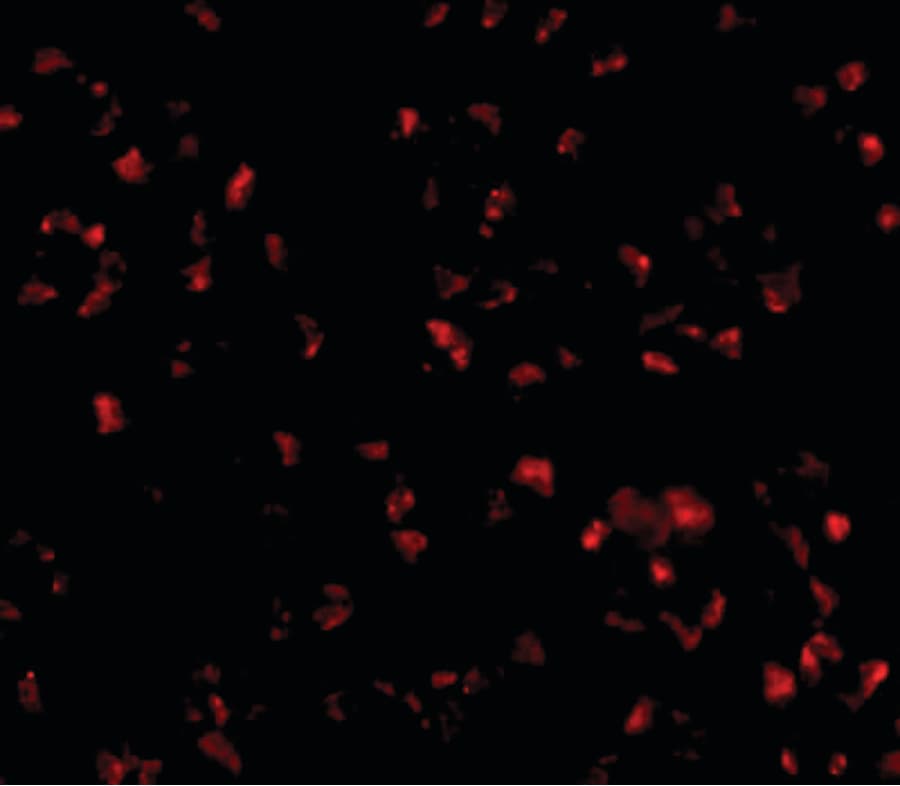 TMEM214 / FLJ20254 Antibody