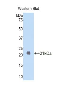 DHH / Desert Hedgehog Antibody (aa43-190, FITC)
