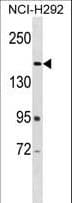 Polyclonal Rabbit anti-Human ARAP2 / CENTD1 Antibody (aa63-93, WB)