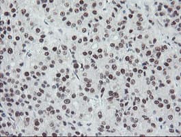 Monoclonal Mouse anti-Human TPRKB Antibody (clone OTI1E9, IHC, WB)