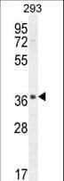 SPACA1 Antibody (aa46-74)