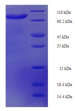 Human KLHL36 Protein (Recombinant His-SUMO)