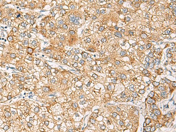 CRABP1 / CRABP Antibody