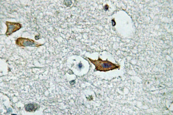 IL5RA / CD125 Antibody (aa19-68)